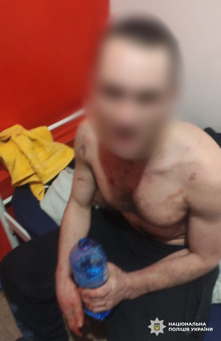 В Киеве мужчина взорвал гранату в хостеле